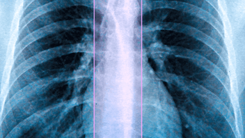 X-ray example image
