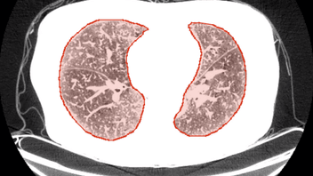 Segmentation